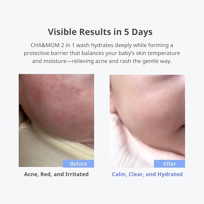 Cha&Mom Head-to-toe Korean Baby Skincare - Hypoallergenic, Plant Based, and Natural Hair & Body Wash, 10.58oz-CubbioJoy