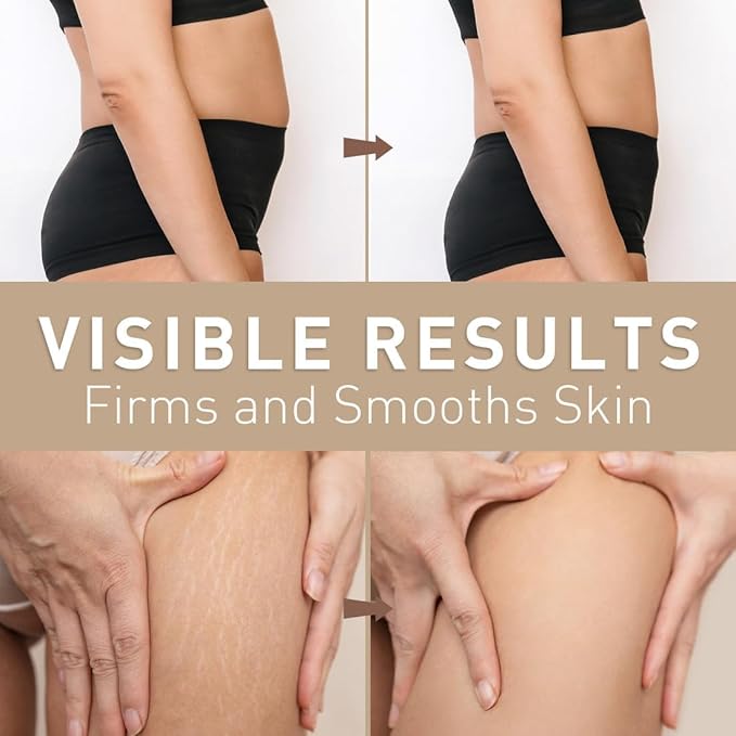 Belly Firming Cream: B Flat Skin Tightening Cream , Cellulite & Stretch Mark Reduction & Tummy Hips Cream & Body Firming for Stomach & Thighs & Arms – 3.38 Fl Oz-CubbioJoy