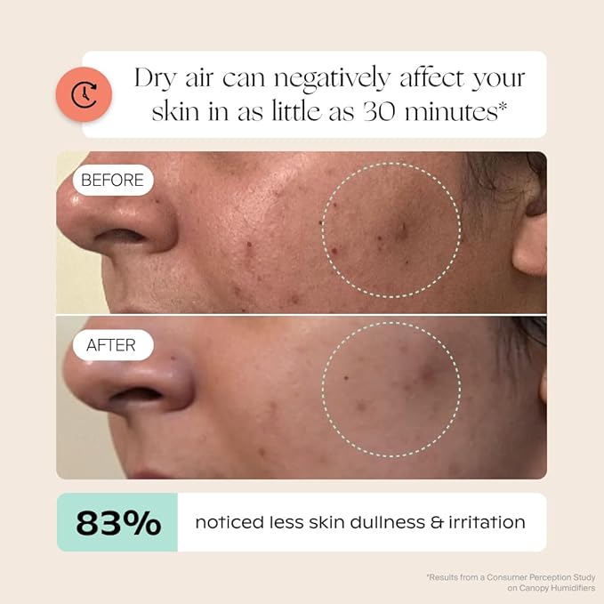 Canopy Bedside Humidifier 2.0, Moonstruck, 36 HR Run Time, 2.5L Capacity - Reading Light & White Noise - Alleviate Symptoms of Allergies, Cold, Dry Skin - Humidifier, Filter, Power Cord & Adapter-CubbioJoy