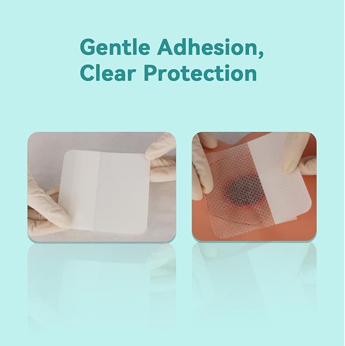 Dimora Silicone Wound Contact Layer, Non-adhering Dressing, Transparent Wound Dressing Pads, 3in x 4in (7.5cm x 10cm), 10 pcs-CubbioJoy