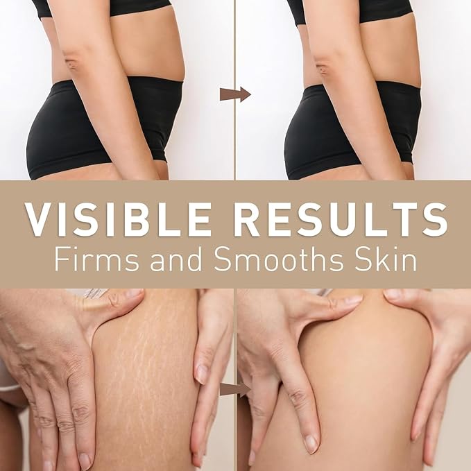 Belly Firming Cream for Tightening & Cellulite – Skin Firming Cream for Stomach, Thighs & Butt – Moisturizing & Lifting Body Lotion for Women-CubbioJoy