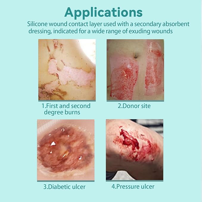 Dimora Silicone Wound Contact Layer, Non-adhering Dressing, Transparent Wound Dressing Pads, 3in x 4in (7.5cm x 10cm), 10 pcs-CubbioJoy