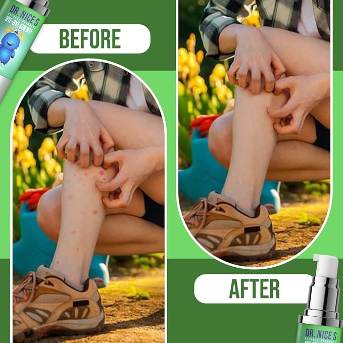 Dr. Nice’s Bye-Bye Bug Bite - Soothing Bug and Mosquito Bite Itch | All Natural | Kid Friendly Self Application | Hydrogel for Bites, Irritation, Skin Discomfort | Soothe Refresh Calm Cool (30 ML)-CubbioJoy