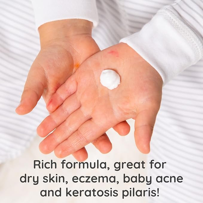Bubbsi Whipped Coconut Oil Baby Lotion for Eczema, Dry Skin, Baby Acne, KP | Organic Coconut Oil, Shea Butter, Vitamin E | Light, Natural Scent | EU Compliant, Vegan (Refillable, 8oz)-CubbioJoy