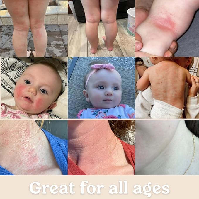 Baby Cream & Baby Serum Power Pair Biome Barrier | For All Skin & Ages | Hydrating Body, Face, Dry Irritated Skin Toddlers, Newborns Skincare (Power Pair)-CubbioJoy