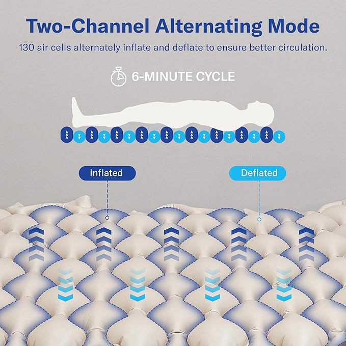 Alcedo Alternating Air Pressure Mattress Pad for Bed Sore and Ulcer Prevention, Hospital & Home Use Medical Mattress Topper for Bedridden Patient, Adjustable Ultra Quiet Pump and Waterproof Cushion-CubbioJoy